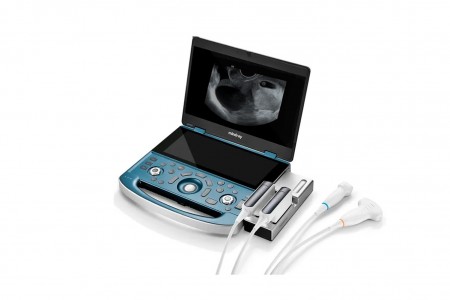 Ультразвуковая система MX8 exp по специальной цене